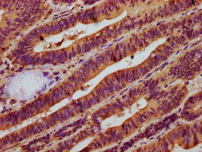 NAGPA Antibody