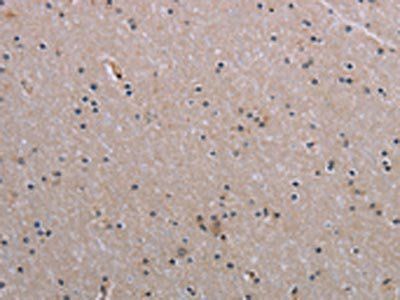 NAIP Antibody