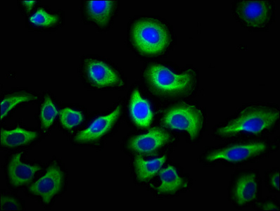NAIP Antibody