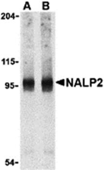 NALP2 Antibody