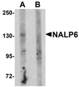NALP6 Antibody