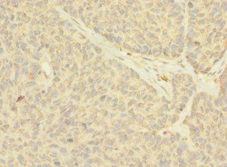 NANOS2 Antibody