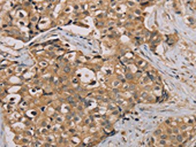 NANOS2 Antibody