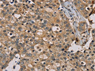 NANOS2 Antibody