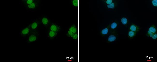 NANS antibody