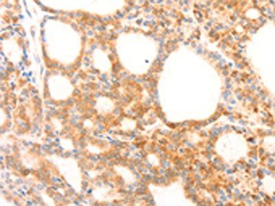 NAP1L1 Antibody
