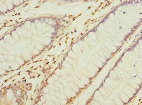 NAPG Antibody