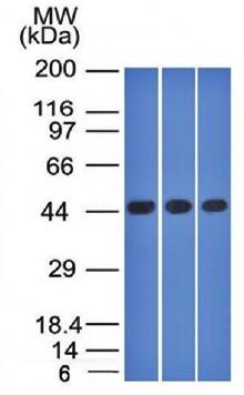 Napsin A (Lung Adenocarcinoma Marker) Antibody