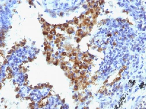 Napsin A (Lung Adenocarcinoma Marker) Antibody