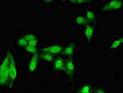 NARF antibody