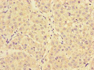 NARS Antibody