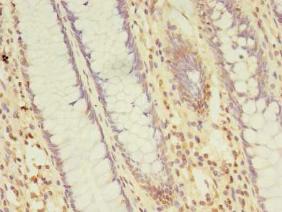 NARS2 Antibody