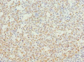 NASP antibody