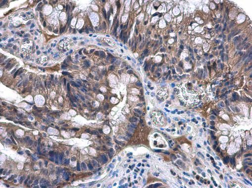 NAT1 Rabbit Polyclonal Antibody