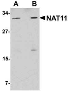 NAT11 Antibody