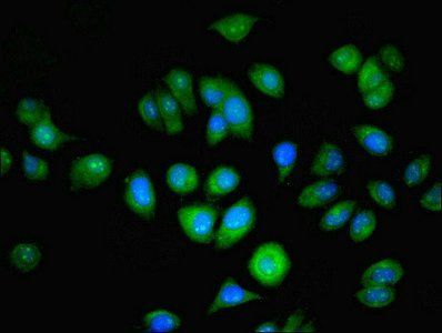 NAT2 antibody