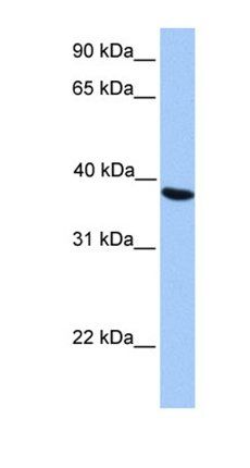 NAT6 antibody
