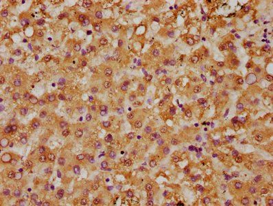 NAT8 Antibody
