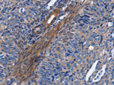 NAT8 Antibody