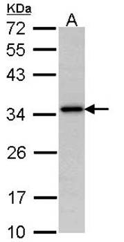 NAT antibody