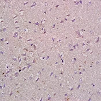 Natriuretic Peptide Receptor B Rabbit Polyclonal Antibody