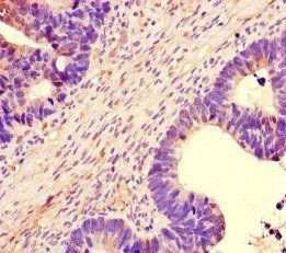 NBEAL2 Antibody