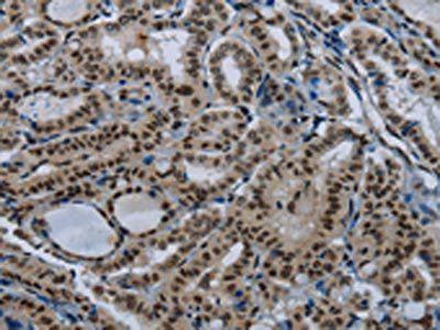 NBL1 Antibody