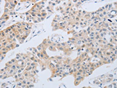 NBN Antibody