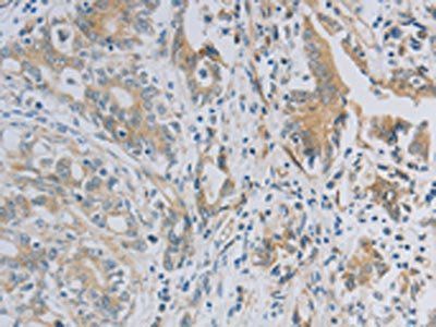 NBN Antibody