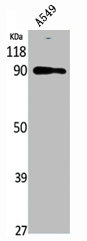 NBN antibody