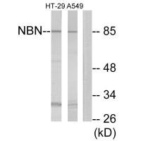 NBN antibody