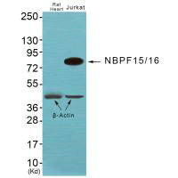 NBPF1/NBPF9/NBPF10/NBPF12/NBPF14/NBPF15/NBPF16/NBPF20 Antibody