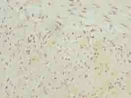 NBPF3 Antibody