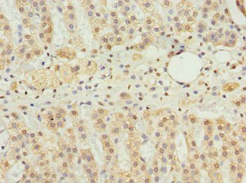 NBR1 Antibody
