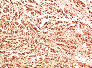 NBR1 antibody