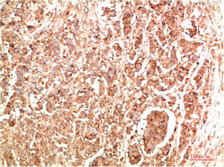NBR1 Antibody
