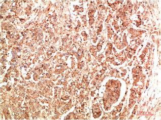 NBR1 antibody