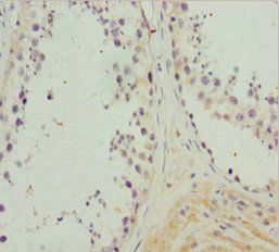 NCALD Antibody