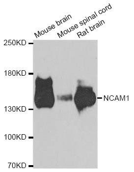NCAM1 antibody