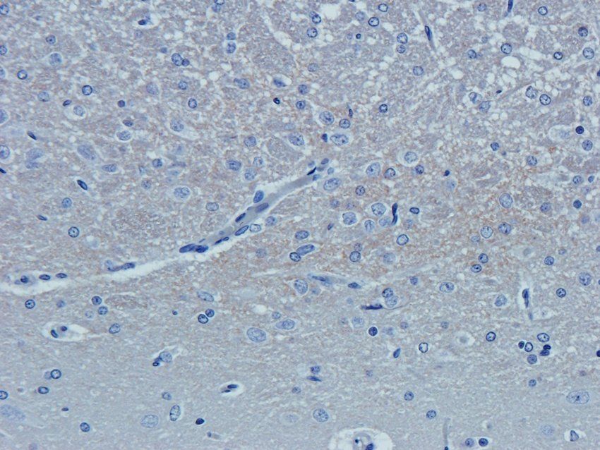 NCAM1 Rabbit Polyclonal Antibody