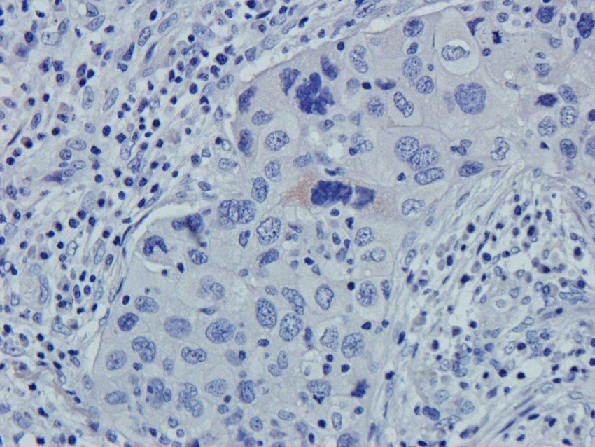 NCAM1 Rabbit Polyclonal Antibody