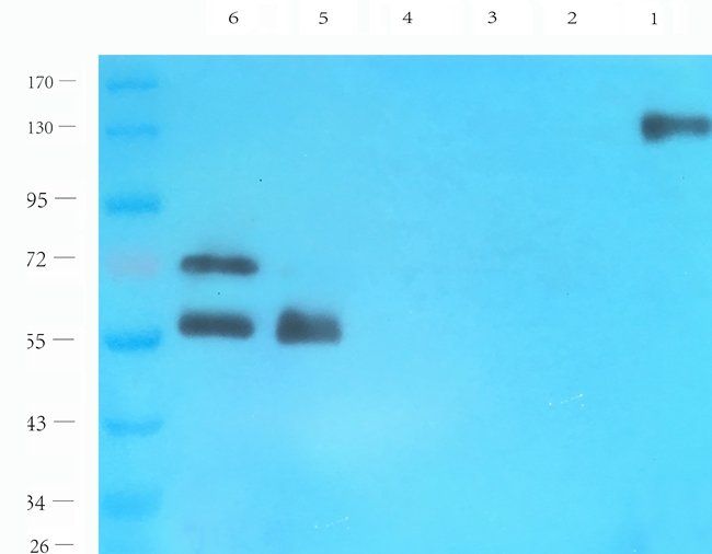 NCAM1 Rabbit Polyclonal Antibody