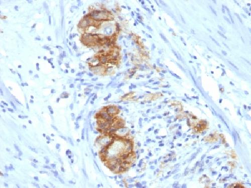 NCAM1 antibody