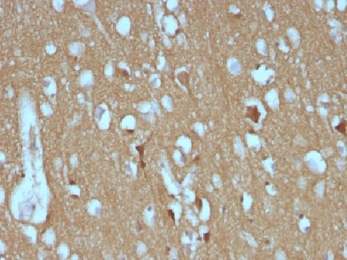 NCAM1 Antibody