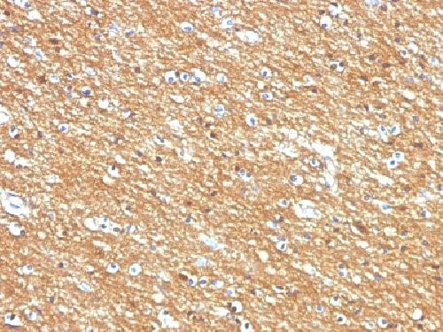 CD56 / NCAM1 / NKH1 (Neuronal Cell Marker) Antibody