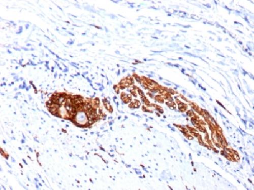 CD56 / NCAM1 / NKH1 (Neuronal Cell Marker) Antibody