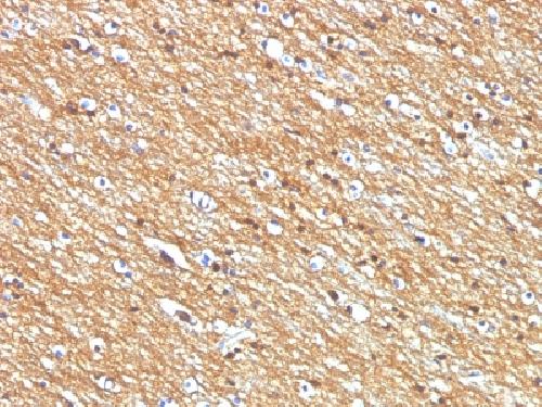 CD56 / NCAM1 / NKH1 (Neuronal Cell Marker) Antibody