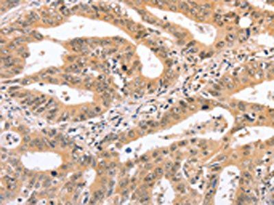 NCAM1 antibody