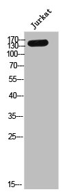 NCAN antibody