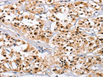 NCAPD3 Antibody